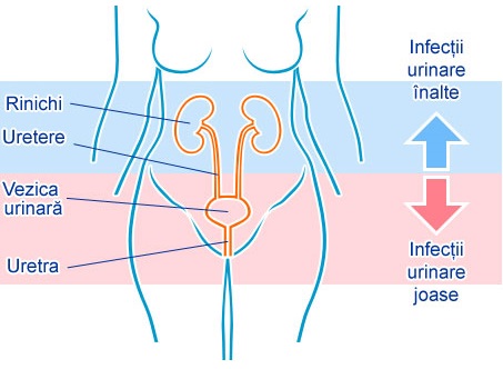 Infectiile urinare, cauze, simptome si tipuri de infectii urinare