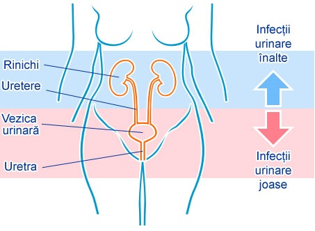 Infecții urinare: cauze, simptome, tratament